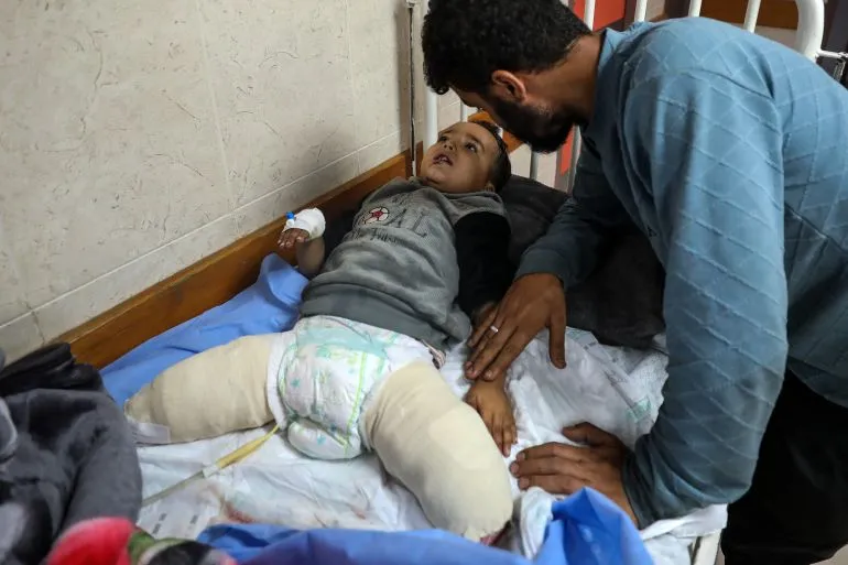 In Gaza, Ahmad lost his family then his legs to Israel’s bombing